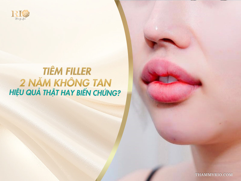 Hình ảnh giải đáp thắc mắc tiêm filler 2 năm không tan là hiệu quả hay biến chứng.