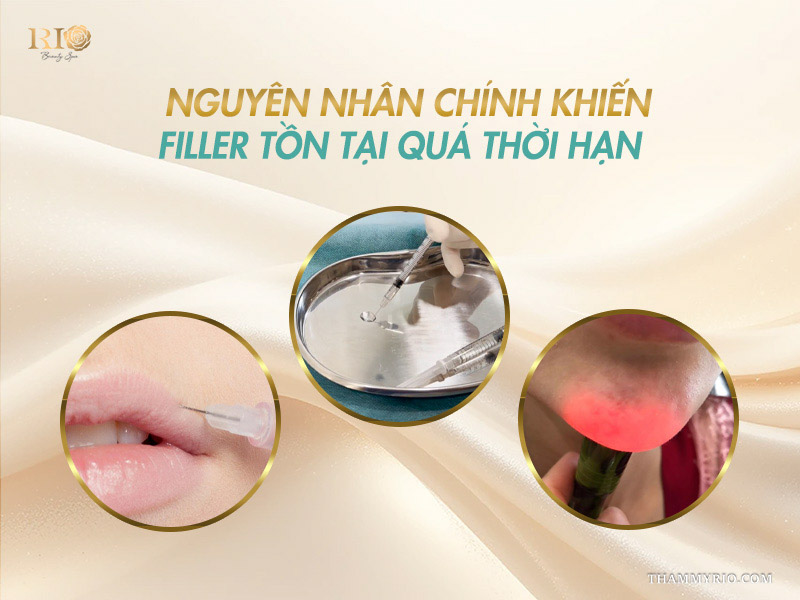 Các nguyên nhân chính dẫn đến sự cố tiêm filler 2 năm không tan.