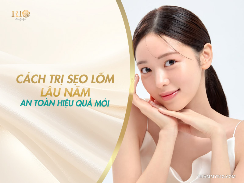 Cách trị sẹo lõm lâu năm hiệu quả
