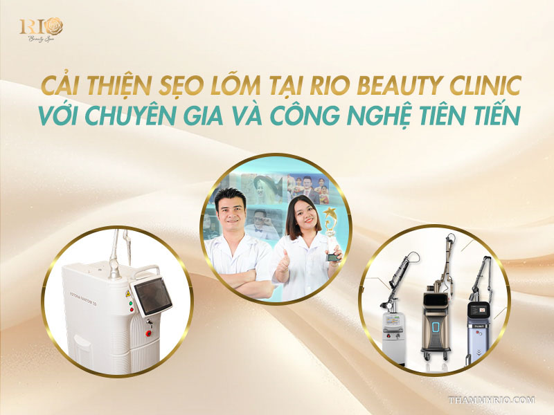 Công nghệ trị sẹo lõm tại Rio Beauty Clinic