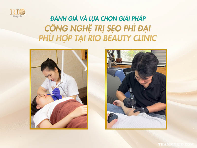 Công nghệ trị sẹo phì đại tại Rio Beauty Clinic